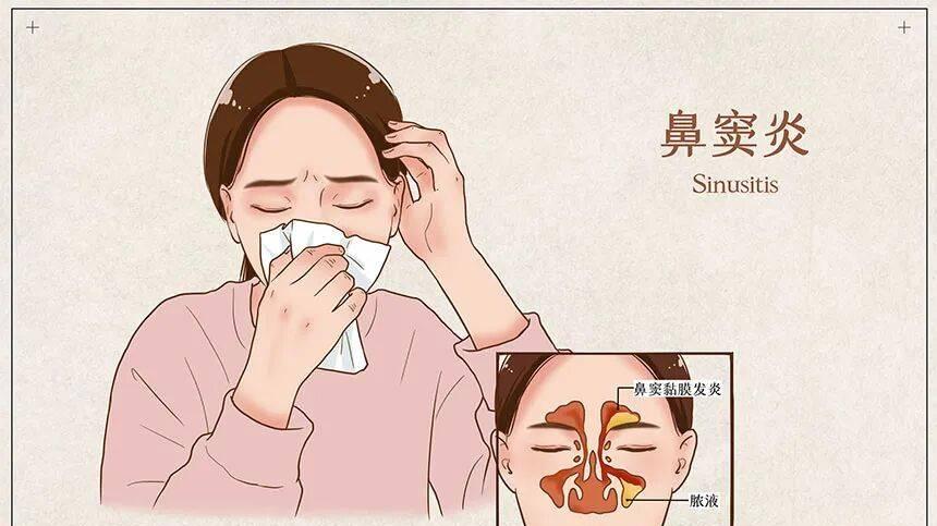 孩子是怎样一步步得鼻窦炎的？家长别再当小毛病了！
