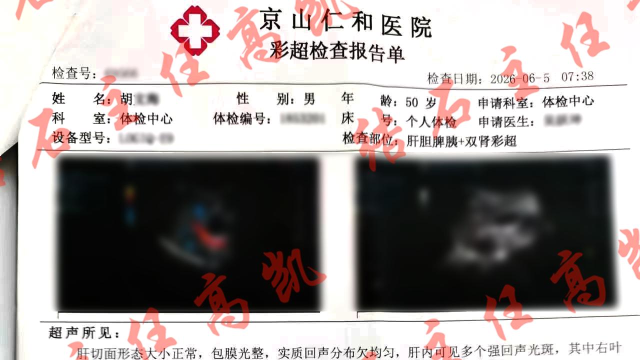胆结石胆囊息肉