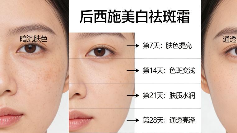 祛斑霜排行榜第一名！后西施美白祛斑霜，专利成分精准淡斑，温和养肤，全家都能用