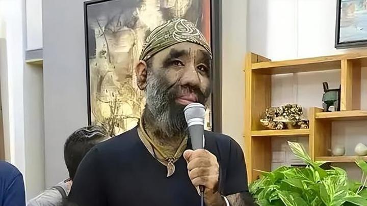 中国第一“毛孩”于震环，被投资1000万包装，41岁迎娶90后娇妻