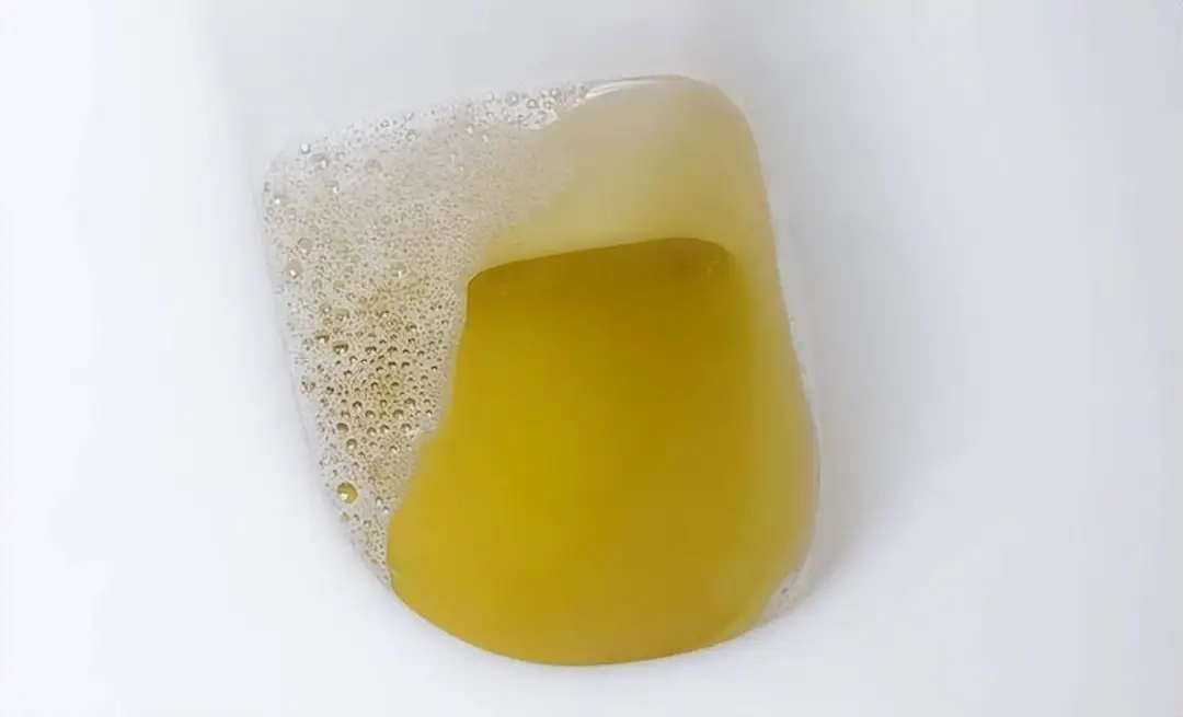 肾病进入中晚期别乱治！保住这一点，比拼命降肌酐更重要！