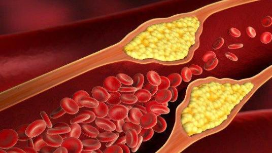 总头晕是“贫血”？医生分了3种情况：西医看供血，中医看气血，别瞎补！