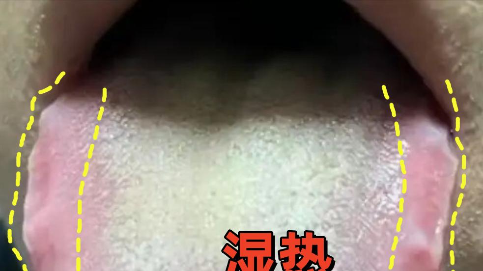 1味清肝猛将，横扫肝内痰瘀，囊肿、血管瘤、肝硬化都怕它