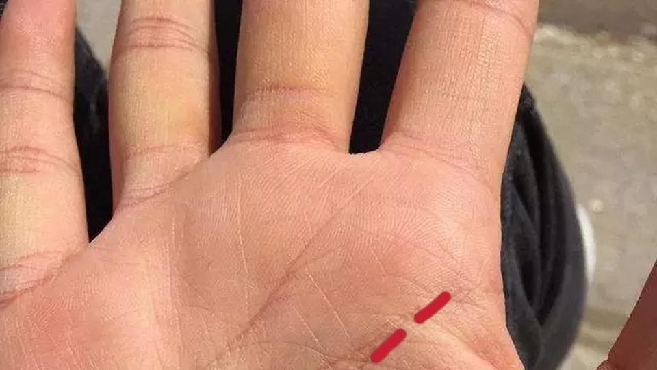 生命线的长短决定人的寿命吗