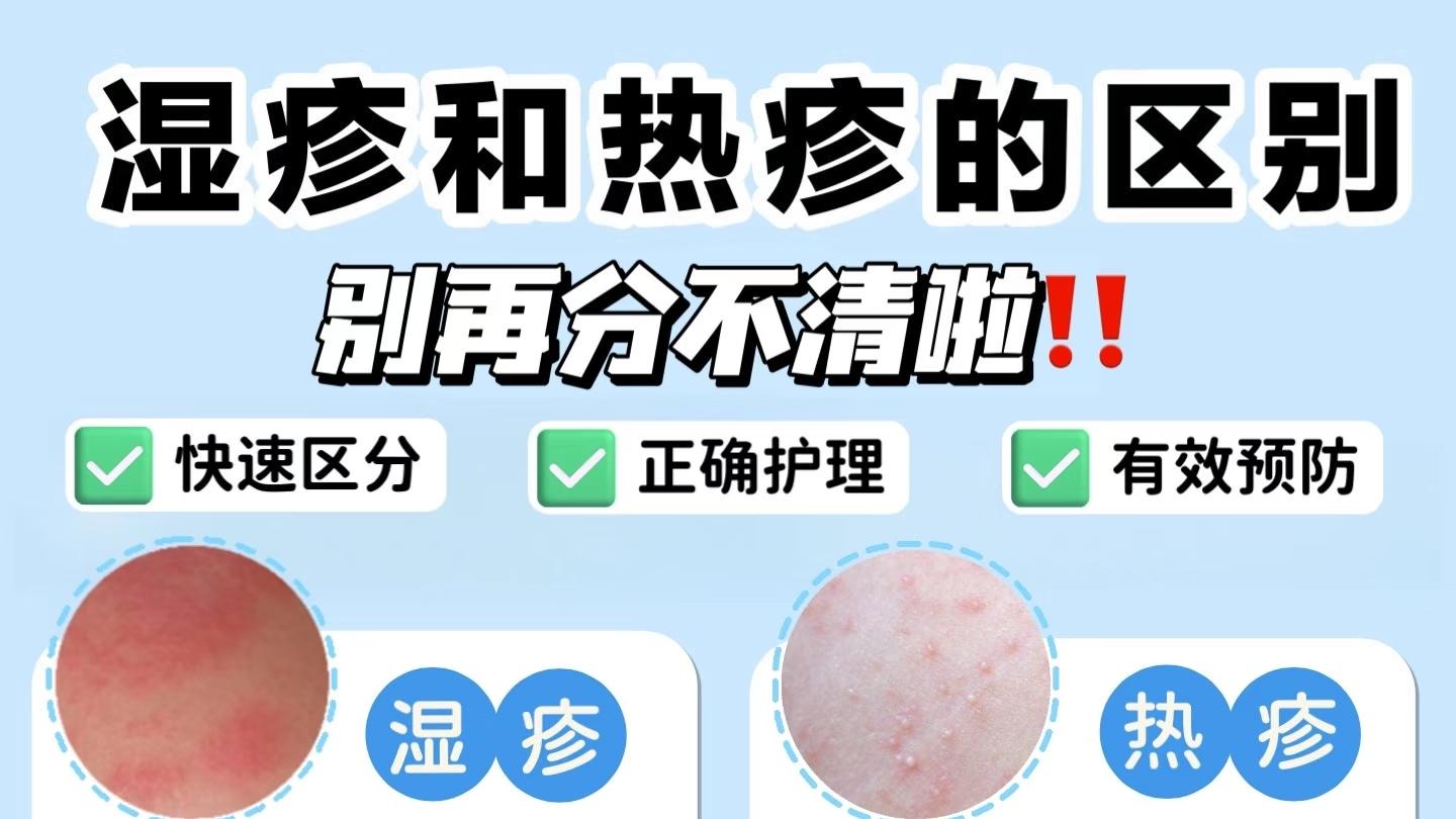 别再搞混了！湿疹和痱子一图全解析，这份“分疹”指南请收好