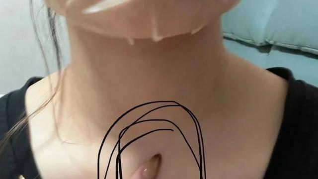 1碗下气汤，降逆气，化痰湿，和脾胃，一升一降，全身气机都打通