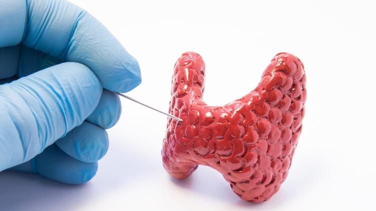 甲状腺癌越来越多？是过度诊断还是真的多了？4类人群做好预防