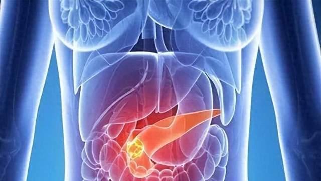 不痛不痒、指标全正常，查出胰腺癌？88%早期病例，都被胃病掩盖