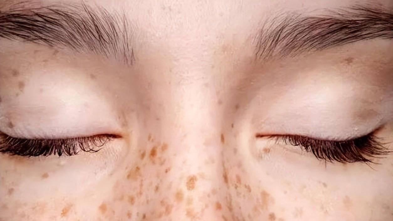 真正的破瘀高手，不是血府逐瘀丸，不是桂枝茯苓丸，而是不起眼的它