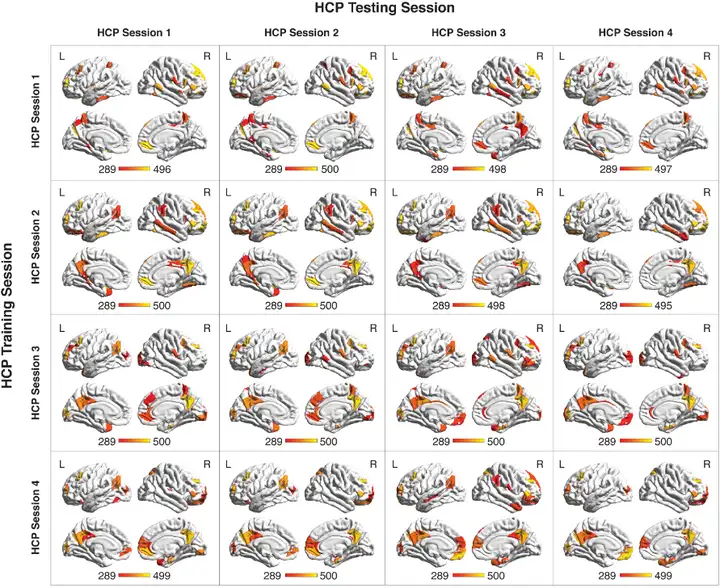 男性和女性大脑差别，比你想象的更大