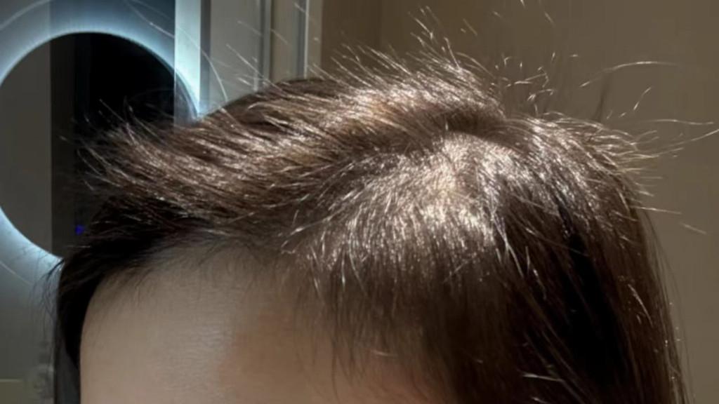 ​头屑反复、头皮痒得睡不着？换了多款洗发水后，我找到了适合自己的洗护方式