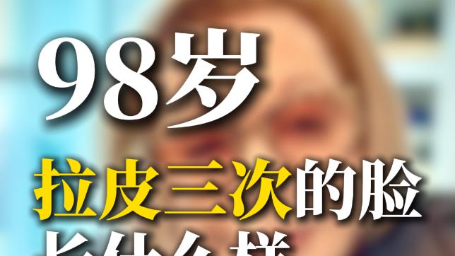 👀98岁拉过三次皮，脸现在长什么样？