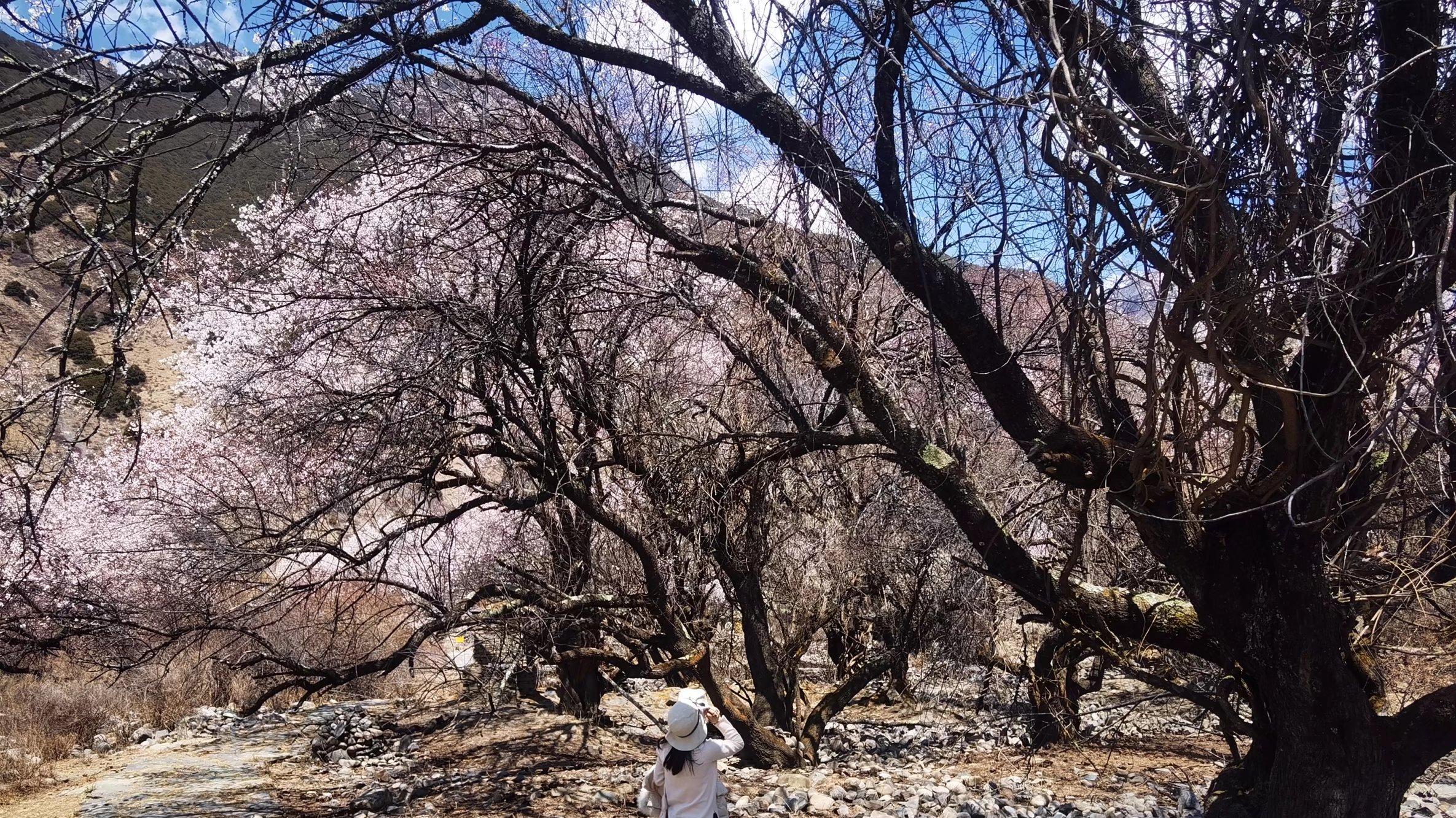 剖腹产中的那些痛