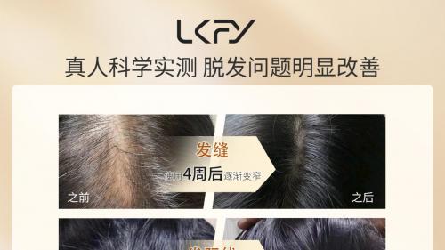 什么牌子的洗发水防脱发生发效果好，2026公认十大口碑好的防脱洗发水排行榜，洗发水防脱发哪个品牌好用