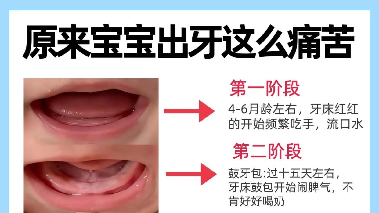 原来宝宝出牙这么痛苦，附应对方法
