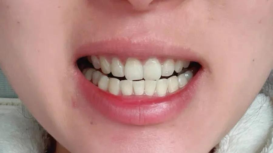 2026年3-4月美白牙膏推荐 去渍焕白+温和护龈 闭眼入不踩雷