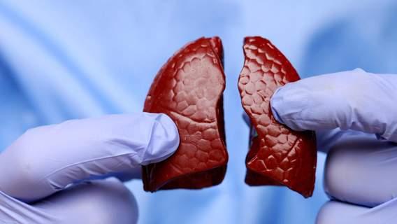 别再“咳”不容缓，出现5类症状，小心肺癌，早期治愈率超90%