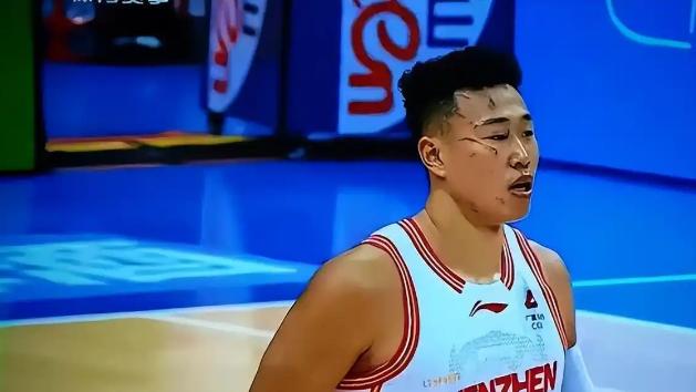 深圳客场拿下排名靠前的青岛，贺希宁变花脸猫