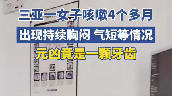 咳嗽4个月竟因吞了颗牙？牙齿松动不是小事，别等出事才重视！