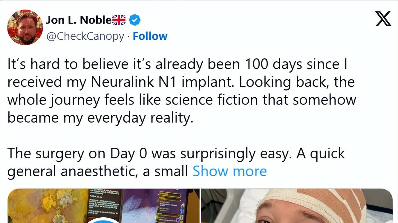 脑机技术再获突破，患者用意念畅玩《魔兽世界》