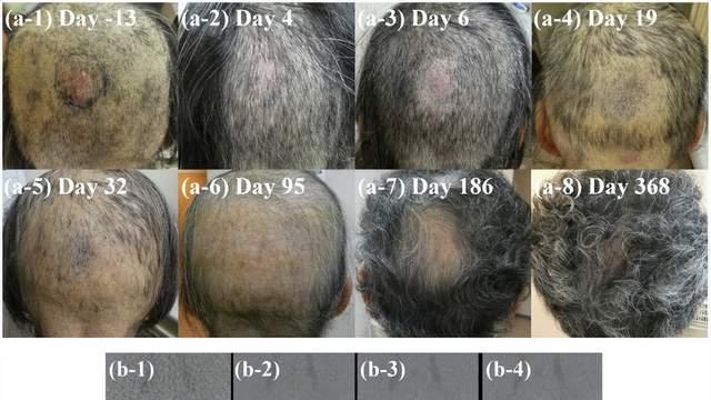 重磅！中国肿瘤治疗新突破：全球前沿硼中子俘获疗法（BNCT）在海南博鳌乐城试运营