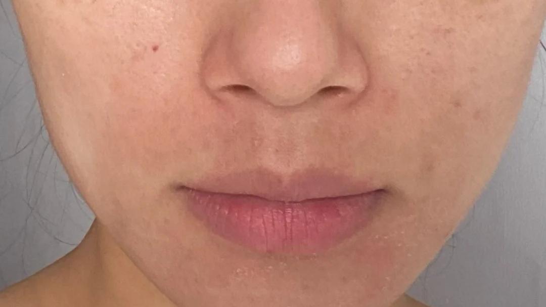 去黑头好用的泥膜 12 天搞定顽固性黑头，亲测巨有效