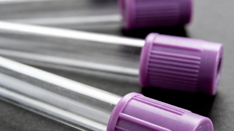 HIV 初筛有反应≠确诊：还要做确证？