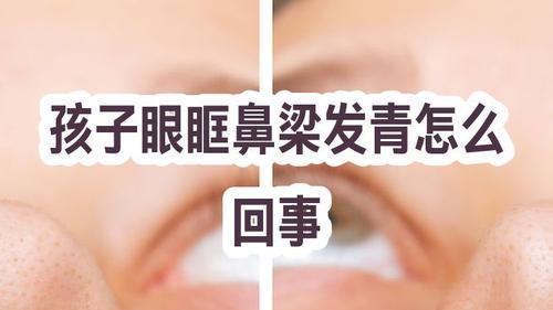 孩子眼眶、鼻梁发青是什么原因？一文讲清，建议收藏