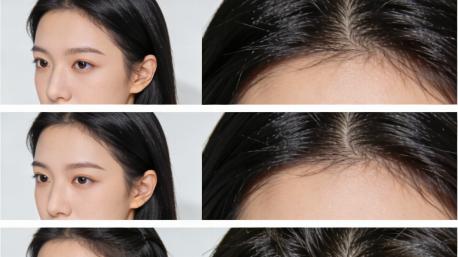 头屑、痒、断发一起来了？折腾半年，我找到了一个适合我的“平衡”办法