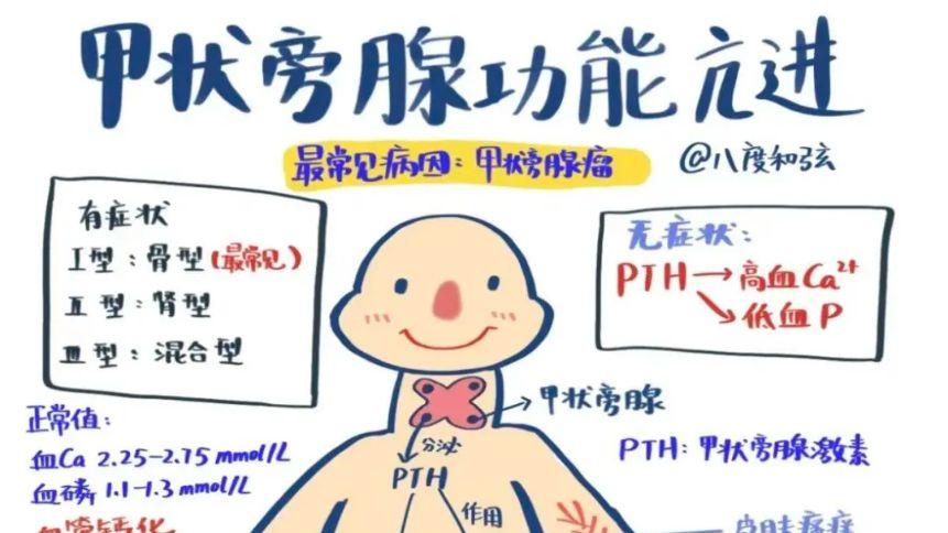 甲状旁腺功能亢进别怕！西那卡塞来帮忙