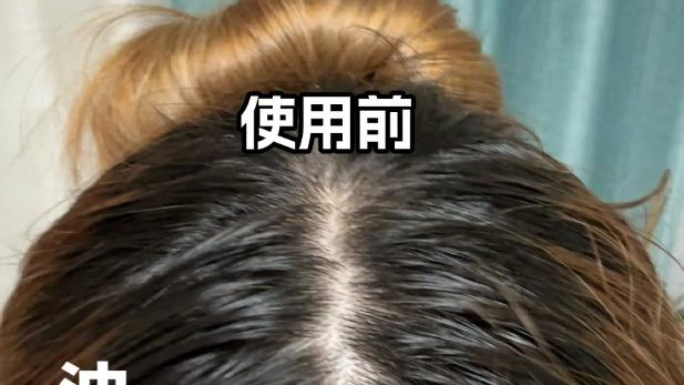 头皮精油哪个牌子好用一点？拾宓控油蓬松，细软塌必入