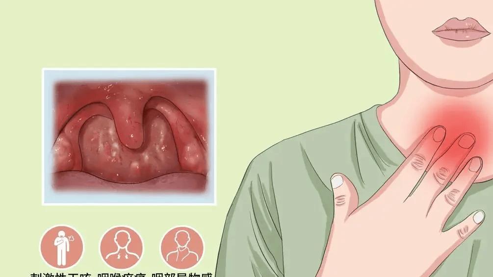 咽喉炎也有“目标人群”——教你5招，轻松预防！