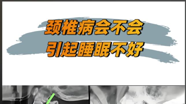 颈椎病怎么治疗才最好？