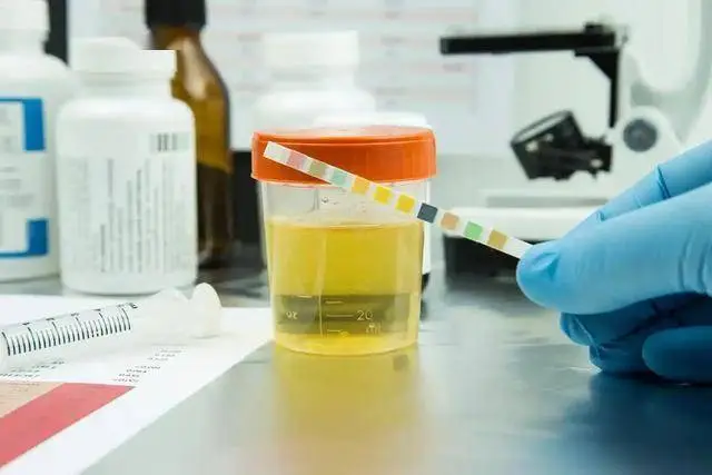 肾病不可怕，怕的是这5项不达标！医生：都正常，肾衰竭离你远远的