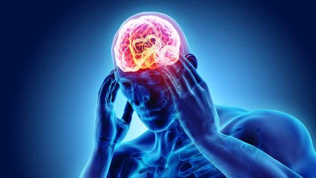 头颅CT完全正常，却天天头痛？你患上了最容易被忽视的原发性头痛