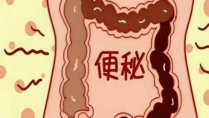 长期便秘不止是堵得慌！别只怪喝水少，你的排便习惯一直在毁肠道