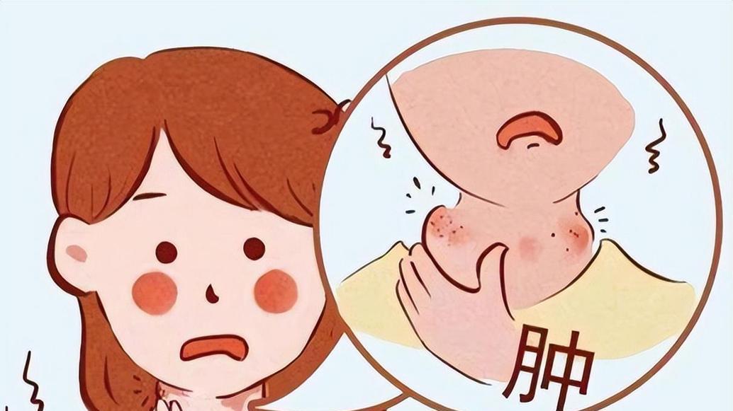 你脖子上摸到小疙瘩，是身体的求救信号，4类症状，小心淋巴结炎