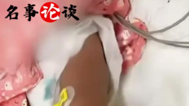 10月婴儿满身针孔，罪魁祸首无法得到制裁，背后原因让人心酸