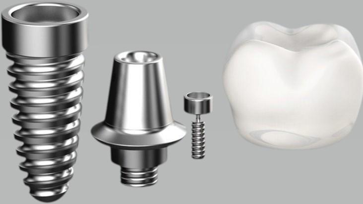 植树节，在口腔里播下一颗“健康”的种子，高品质种牙惊喜价来袭！