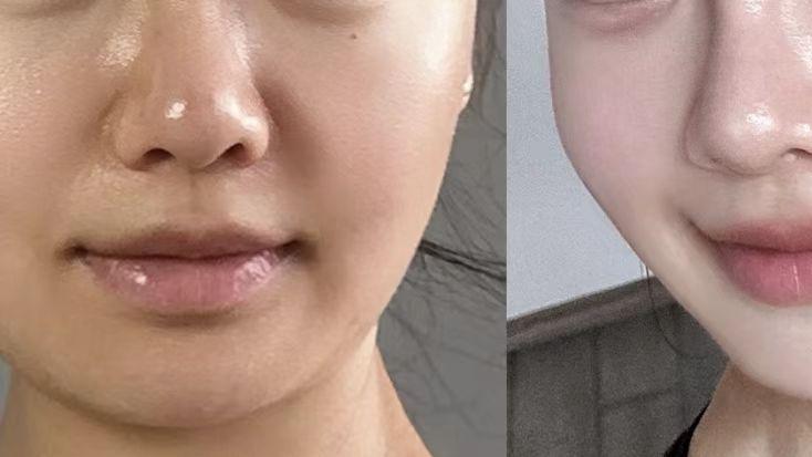 轻熟龄肌护肤分享：这些年我关注的初老问题与成分选择