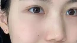 2026年护肤观察：“全肤质适用”的抗老面膜，是科学还是营销？