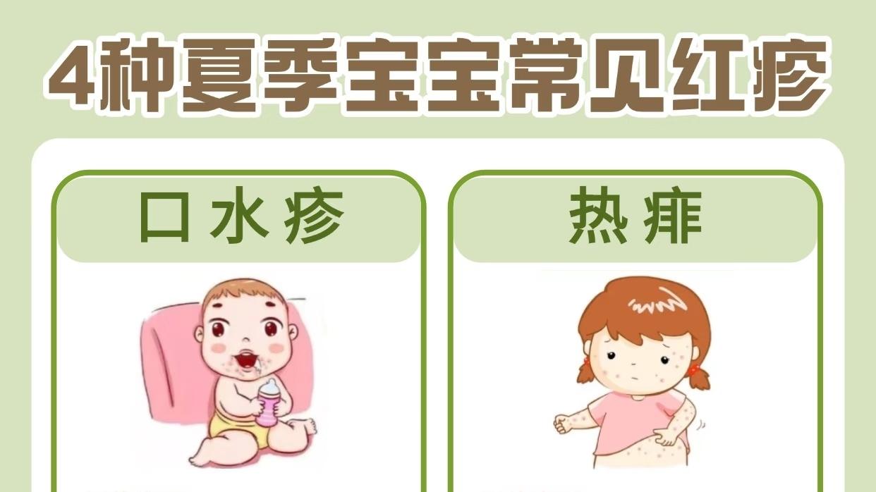 宝妈速看！4种夏季宝宝红疹大揭秘