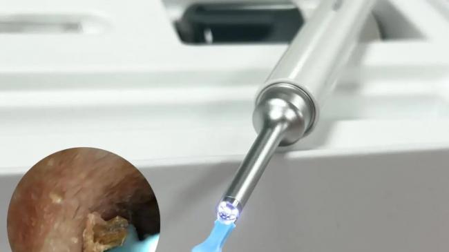 掏耳勺哪个品牌好？婴儿掏耳勺什么牌子好？小孩掏耳朵神器推荐