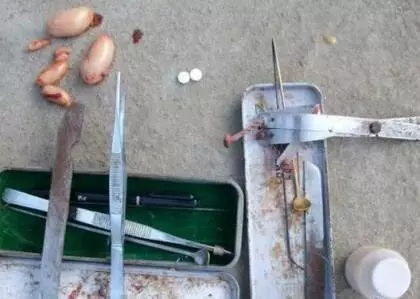 太监阉割全过程，千万别手欠啊......看了你会疼的