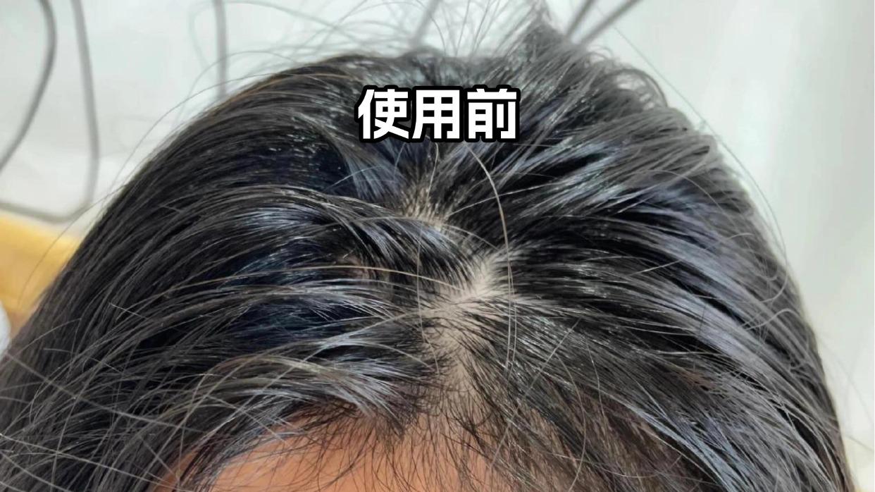 产后头皮适合用什么精油保养？实测十大品牌，帮宝妈避坑不踩雷