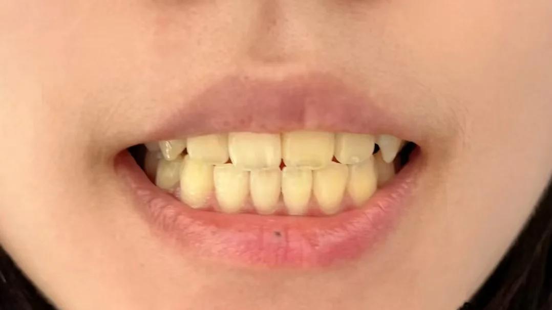 2026美白牙膏推荐TOP7：LBR净味皓齿领衔，去黄护龈不伤牙