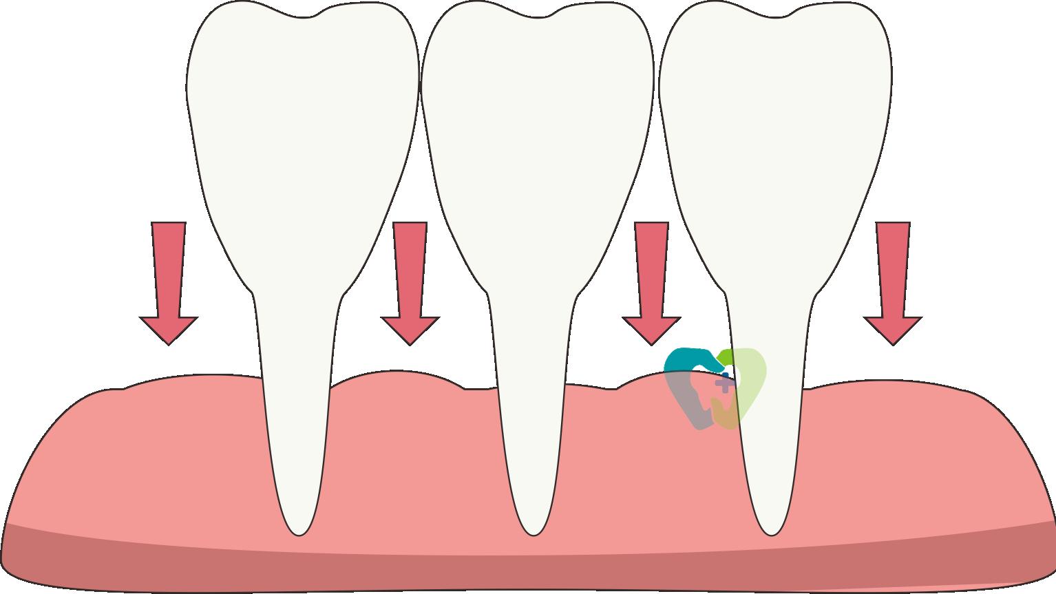 牙龈萎缩了还能长回来吗？牙医说实话了，这三件事现在做还不晚
