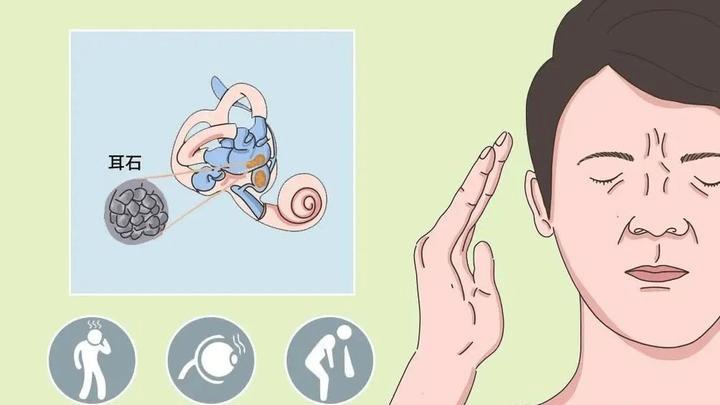 黄景瑜跨年上台前突发耳石症，突发耳石症是什么感觉？