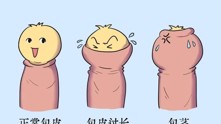 小儿包皮环切和套扎术哪个好