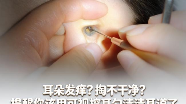 儿童挖耳勺哪个牌子好？可视挖耳勺哪个品牌好？挖耳勺十大品牌排行